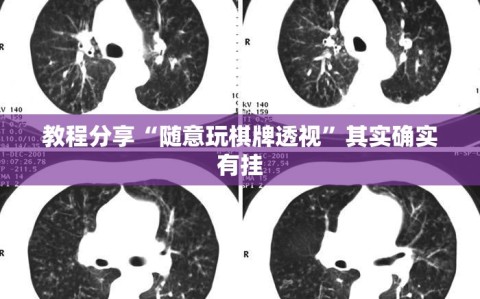 教程分享“随意玩棋牌透视”其实确实有挂