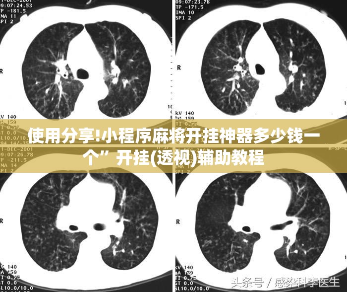 使用分享!小程序麻将开挂神器多少钱一个”开挂(透视)辅助教程
