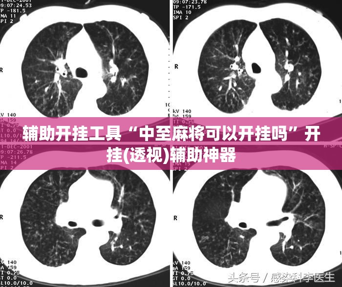 辅助开挂工具“中至麻将可以开挂吗	”开挂(透视)辅助神器