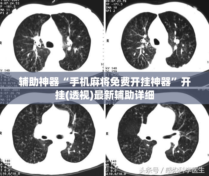 辅助神器“手机麻将免费开挂神器”开挂(透视)最新辅助详细