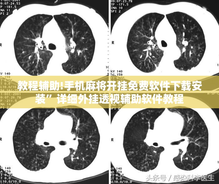 教程辅助!手机麻将开挂免费软件下载安装”详细外挂透视辅助软件教程