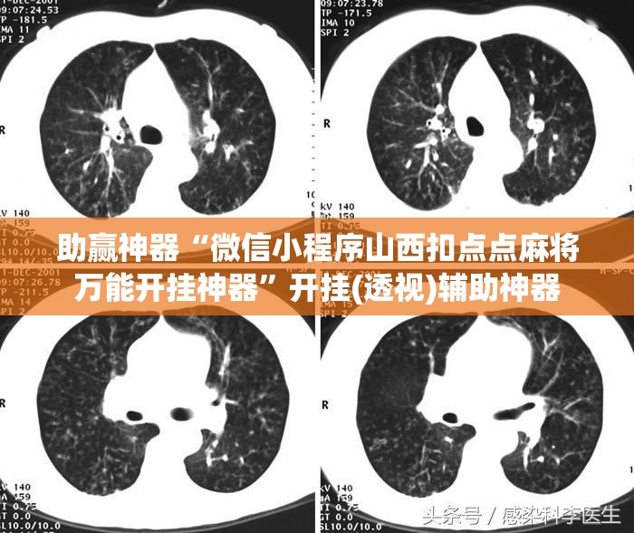 助赢神器“微信小程序山西扣点点麻将万能开挂神器”开挂(透视)辅助神器