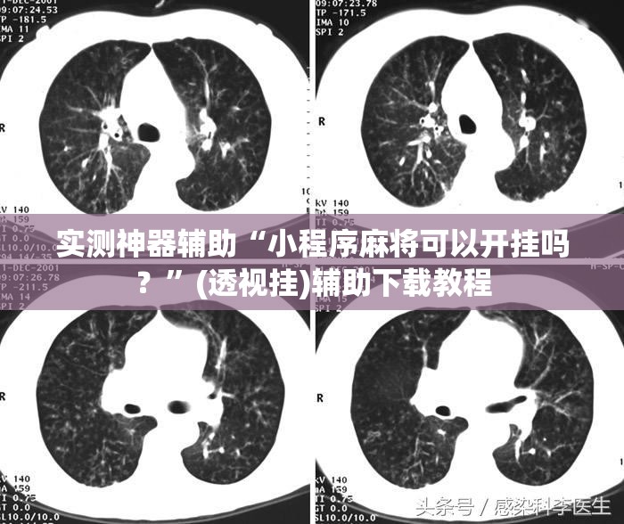 实测神器辅助“小程序麻将可以开挂吗？”(透视挂)辅助下载教程